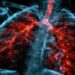 長期咳嗽別輕忽!結核病與肺阻塞(COPD)辨別指南:症狀、成因與治療一次解析!
