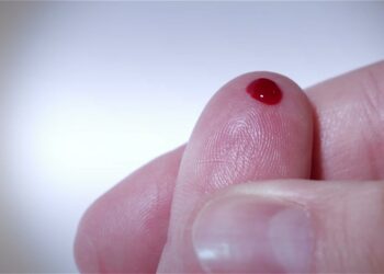 血癌無症狀如何預防？持續性出現「這些症狀」得當心！「這些名人」也曾與血癌對抗