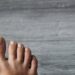 逆生性指甲是「凍甲」？與甲溝炎不一樣？皮膚科醫提4大成因、2大治療方式