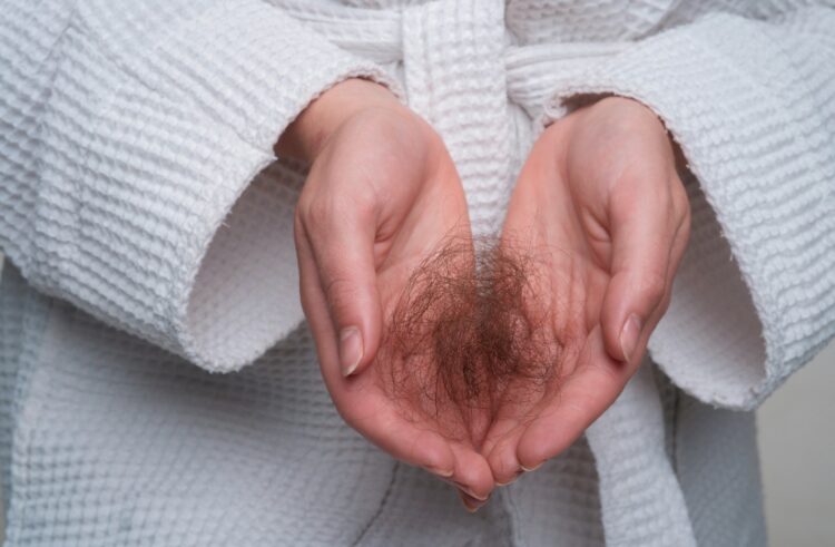 Hair loss. Problem hair in hand, isolated. Damaged unhealthy hair in hand closeup