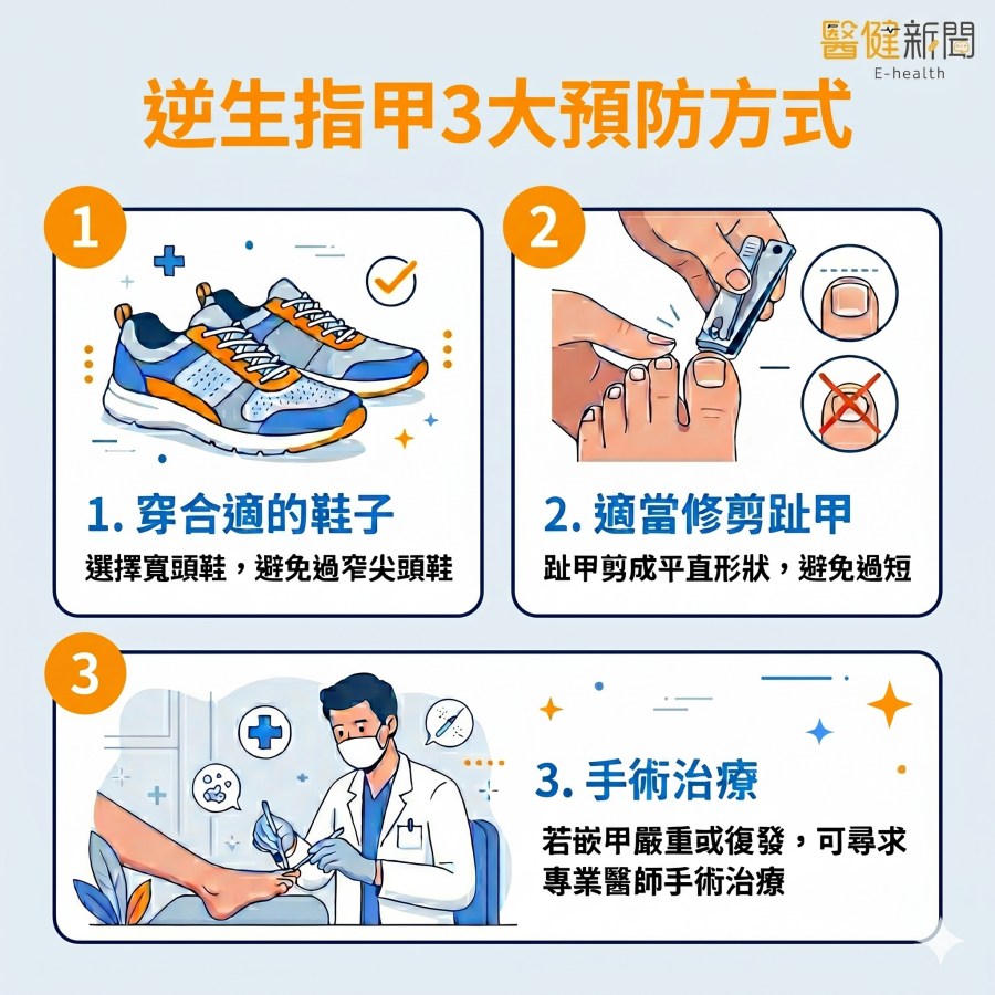 逆生性指甲常見成因與治療方式示意圖：外傷壓力、緊鞋摩擦