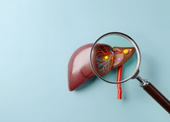 脂肪肝可以好嗎？營養師揭「8大類」護肝食物、「5招」遠離脂肪肝