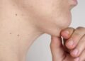 別讓脖子「洩漏年齡」！皮膚科醫揭雙下巴非全是「胖」的錯，想擺脫需要「組合拳」