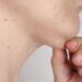 別讓脖子「洩漏年齡」！皮膚科醫揭雙下巴非全是「胖」的錯，想擺脫需要「組合拳」