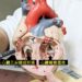 東港安泰醫院複合性心臟手術 助86歲阿嬤成功延壽