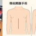 高齡男腹痛就醫發現「胃癌」　高市大同醫院運用微創手術助康復